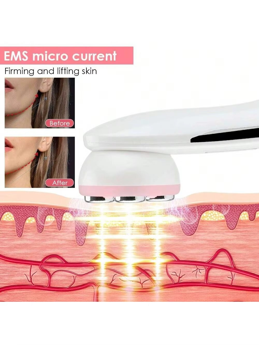 מכשיר מקצועי לניקוי פנים – פילינג, הסרת שחורים ותאי עור מתים, מרענן ומחדש את העור